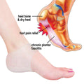 2PCS Silicone Heel Socks Cracked Foot Skin Protectors - Beige - Offer Hunts