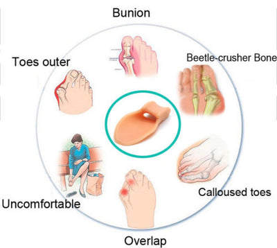 Toe separators and spreaders for Bunion, Overlapping Toes and Drift Pain [PAIR] - Offer Hunts
